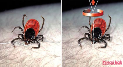 Как вытащить клеща самостоятельно? 